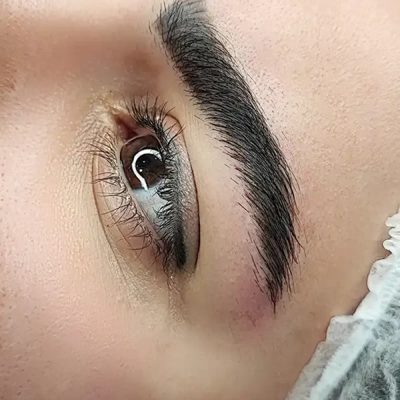 فیبروز ابرو