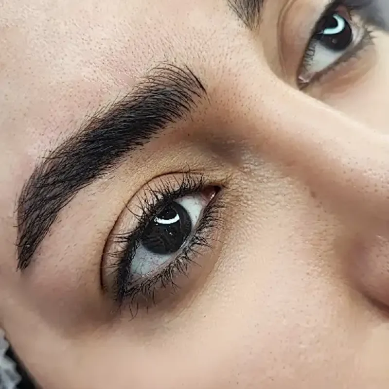 فیبروز ابرو