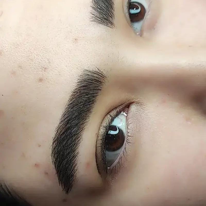 فیبروز ابرو