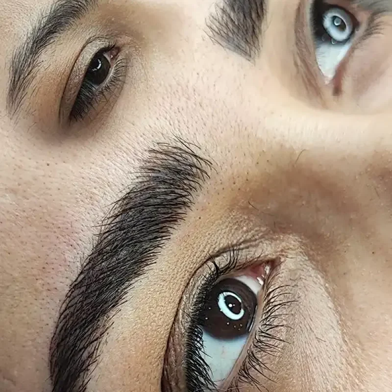 فیبروز ابرو